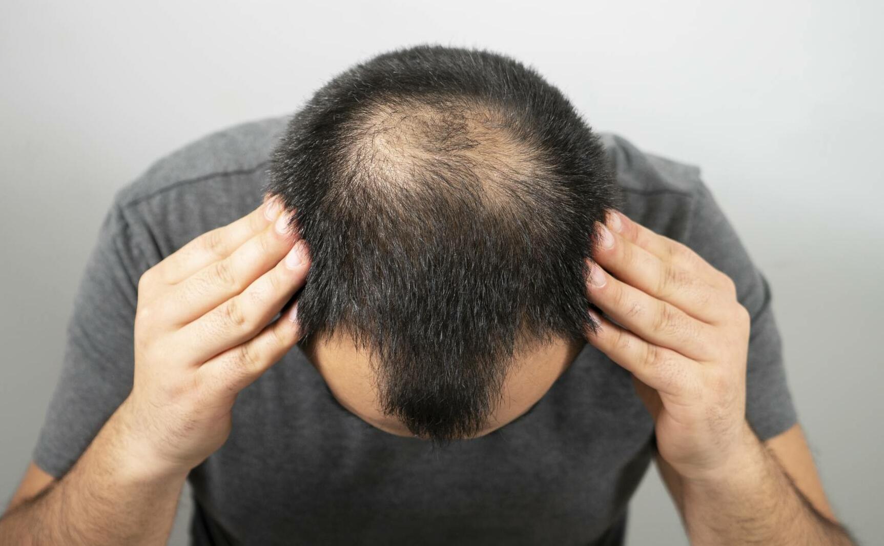 Buy Hair Loss Treatment Online - Daily Chemist